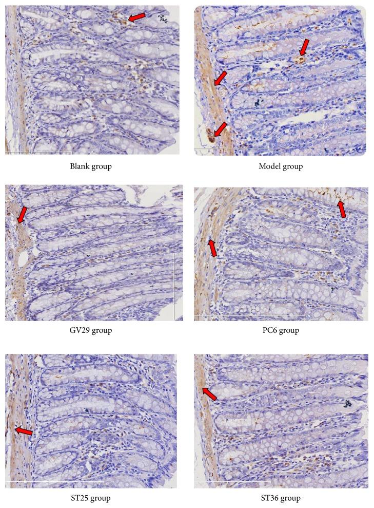 https://cdn.ncbi.nlm.nih.gov/pmc/blobs/b82b/6377955/a2ee8b752a95/ECAM2019-4213928.005.jpg