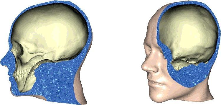https://cdn.ncbi.nlm.nih.gov/pmc/blobs/b82f/6201798/303f9f5dc189/TFSR_A_1469185_F0011_C.jpg
