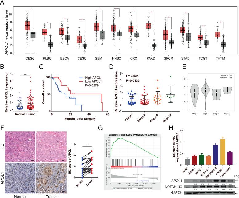 https://cdn.ncbi.nlm.nih.gov/pmc/blobs/b82f/8329288/ffc9512aea45/41419_2021_3985_Fig2_HTML.jpg