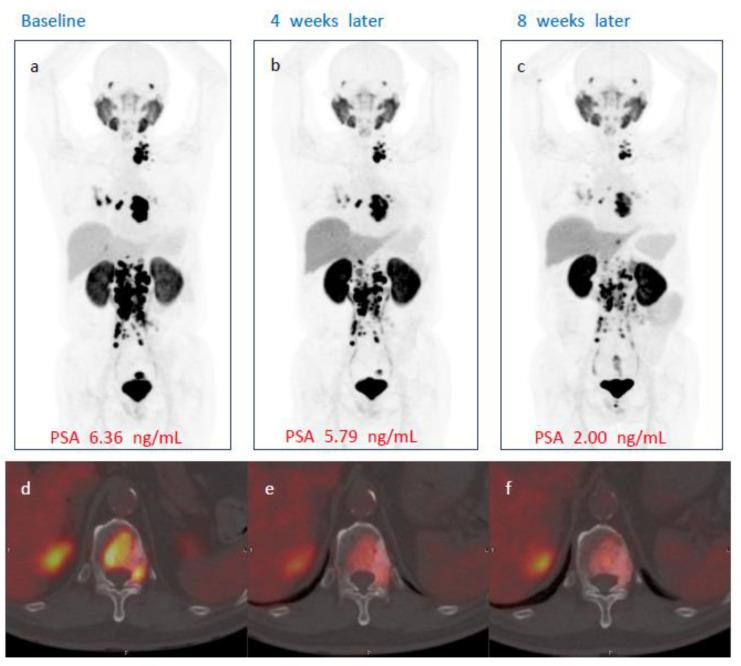 https://cdn.ncbi.nlm.nih.gov/pmc/blobs/b831/9777064/1c4a68a2850b/cancers-14-06225-g003.jpg