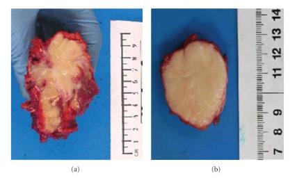 https://cdn.ncbi.nlm.nih.gov/pmc/blobs/b832/2821775/8c82918df6d1/SRCM2009-765927.001.jpg