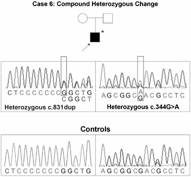 https://cdn.ncbi.nlm.nih.gov/pmc/blobs/b833/3179293/5daeebf0e535/jbmr0026-0666-f4.jpg