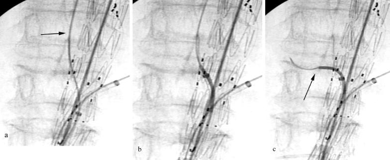 https://cdn.ncbi.nlm.nih.gov/pmc/blobs/b834/9550412/ad61a9c0fe9e/2432-0935-5-3-0103-g004.jpg