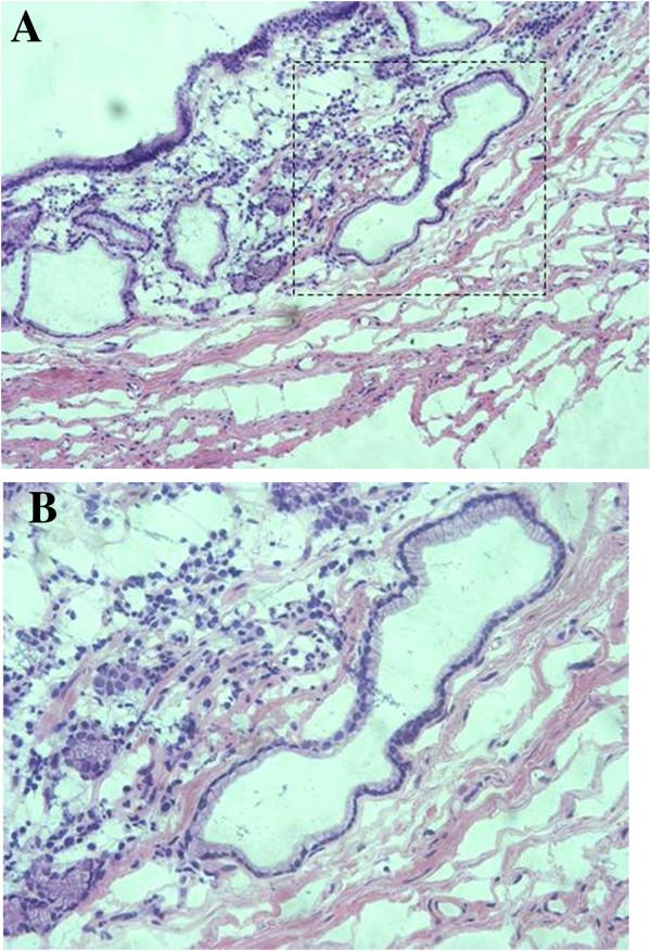 https://cdn.ncbi.nlm.nih.gov/pmc/blobs/b838/4030027/ce6b75c1a049/1477-7819-12-133-3.jpg