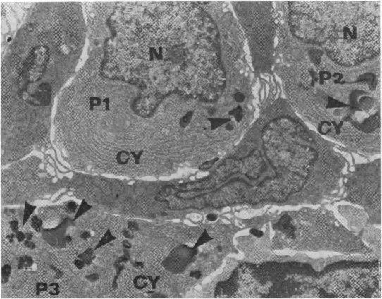 https://cdn.ncbi.nlm.nih.gov/pmc/blobs/b839/1411475/03734517600b/gut00474-0046-b.jpg