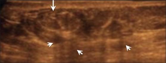 https://cdn.ncbi.nlm.nih.gov/pmc/blobs/b842/2890934/c8bd1835c69b/IJRI-20-98-g015.jpg