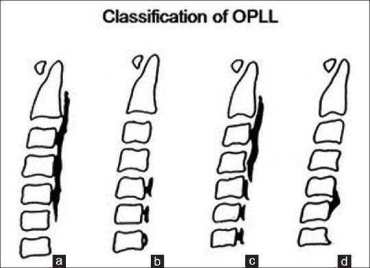 https://cdn.ncbi.nlm.nih.gov/pmc/blobs/b843/4323963/e23bcfd07ab4/AJNS-9-196-g001.jpg