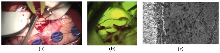 https://cdn.ncbi.nlm.nih.gov/pmc/blobs/b847/8036330/b1314a49e066/cancers-13-01616-g003.jpg