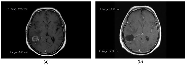 https://cdn.ncbi.nlm.nih.gov/pmc/blobs/b847/8036330/c6122d72ef5e/cancers-13-01616-g002.jpg