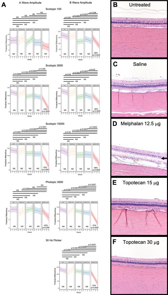 https://cdn.ncbi.nlm.nih.gov/pmc/blobs/b84a/8788260/95130aaa227d/bjophthalmol-2020-318529f04.jpg