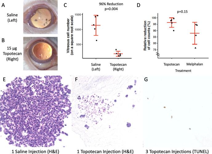 https://cdn.ncbi.nlm.nih.gov/pmc/blobs/b84a/8788260/b682f4d9662a/bjophthalmol-2020-318529f03.jpg