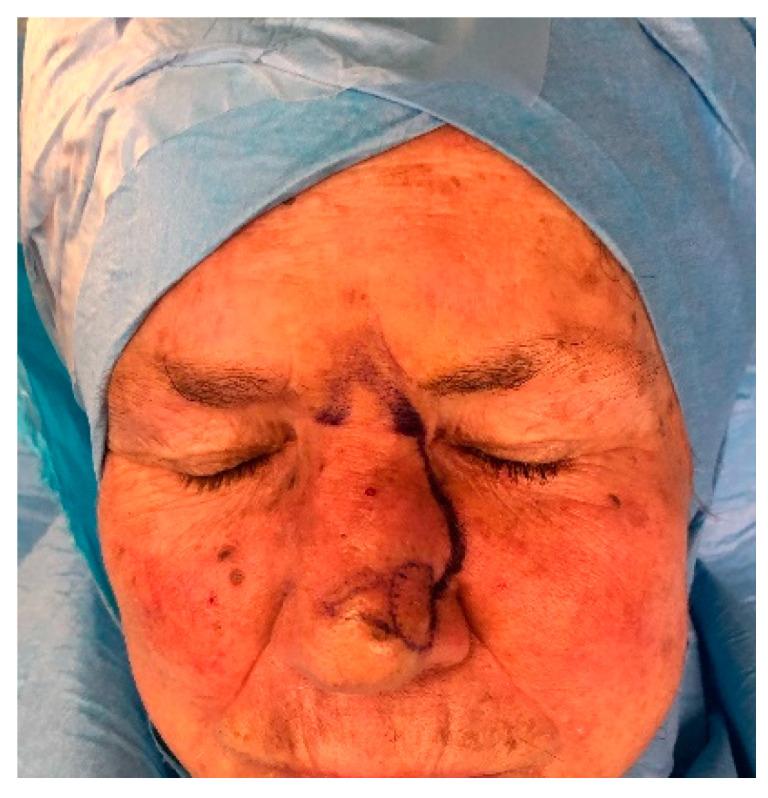 https://cdn.ncbi.nlm.nih.gov/pmc/blobs/b84c/7760386/337286835c38/medicina-56-00639-g006.jpg