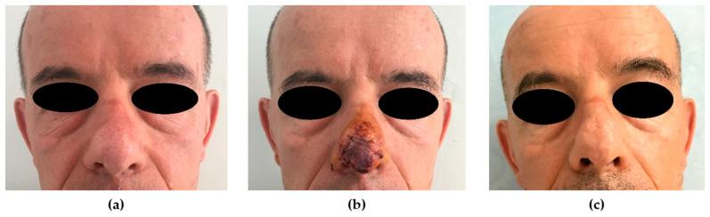 https://cdn.ncbi.nlm.nih.gov/pmc/blobs/b84c/7760386/535985e3a24b/medicina-56-00639-g002.jpg