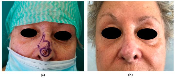 https://cdn.ncbi.nlm.nih.gov/pmc/blobs/b84c/7760386/6691cfb4565e/medicina-56-00639-g008.jpg