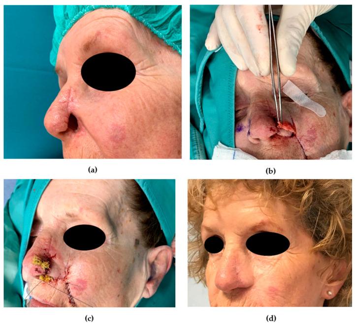 https://cdn.ncbi.nlm.nih.gov/pmc/blobs/b84c/7760386/d7bcd14e7e7d/medicina-56-00639-g009.jpg