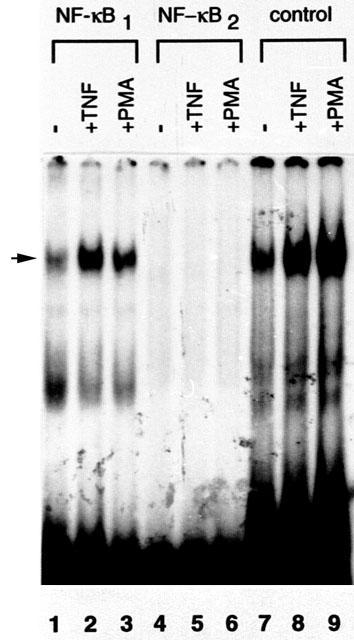 https://cdn.ncbi.nlm.nih.gov/pmc/blobs/b853/140029/2595791adf30/1471-2199-3-16-8.jpg