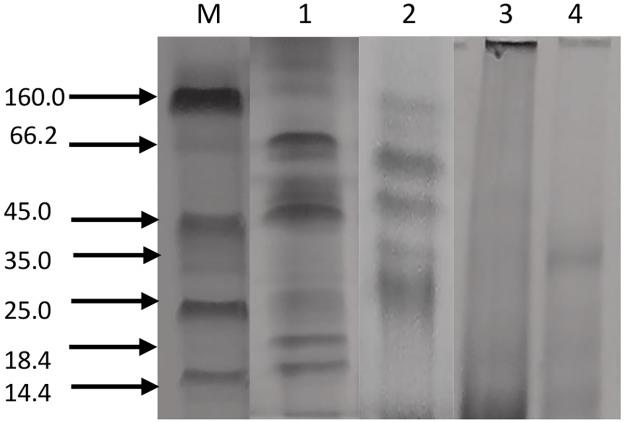 https://cdn.ncbi.nlm.nih.gov/pmc/blobs/b85b/5800569/d3ce8b4b3ce9/pone.0191265.g002.jpg