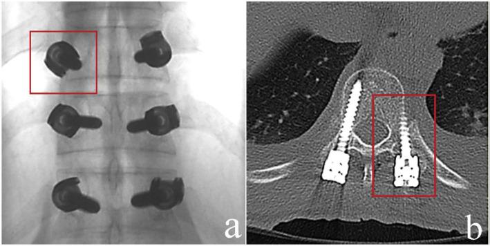 https://cdn.ncbi.nlm.nih.gov/pmc/blobs/b865/7608845/a9ac4f0311af/bmed-10-02-030f4.jpg