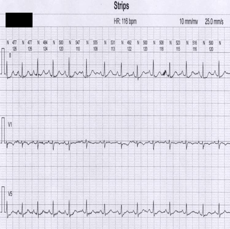 https://cdn.ncbi.nlm.nih.gov/pmc/blobs/b868/11301768/df408971718e/cureus-0016-00000064008-i02.jpg