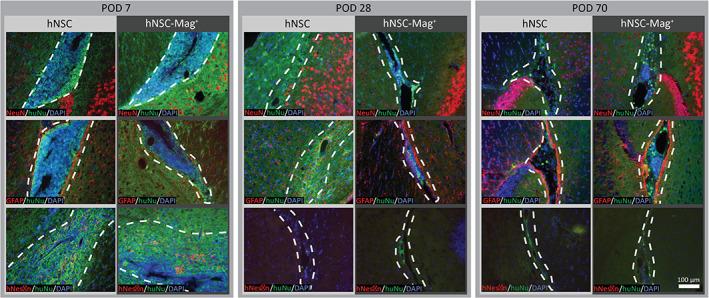 https://cdn.ncbi.nlm.nih.gov/pmc/blobs/b869/7780819/59069e2ca75d/SCT3-10-83-g007.jpg
