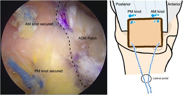 https://cdn.ncbi.nlm.nih.gov/pmc/blobs/b86f/12126013/7595f706ace5/gr12.jpg