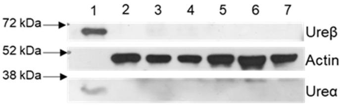 https://cdn.ncbi.nlm.nih.gov/pmc/blobs/b86f/8949269/00dbcc6df647/ijms-23-03091-g006.jpg