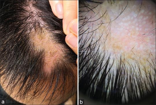 https://cdn.ncbi.nlm.nih.gov/pmc/blobs/b872/7659739/38a6d5870f0c/IJT-12-138-g001.jpg