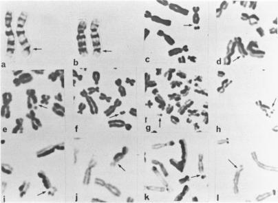 https://cdn.ncbi.nlm.nih.gov/pmc/blobs/b877/1686118/b52cc1db1162/ajhg00190-0069-a.jpg