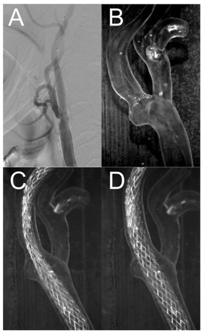 https://cdn.ncbi.nlm.nih.gov/pmc/blobs/b879/11396471/5df9c698a04f/jcm-13-05115-g012.jpg