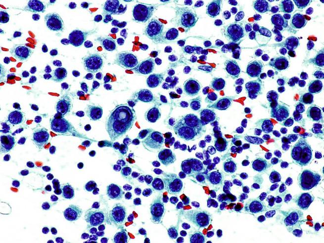 https://cdn.ncbi.nlm.nih.gov/pmc/blobs/b881/9805223/2cb08cac69c6/JUM-41-3137-g008.jpg