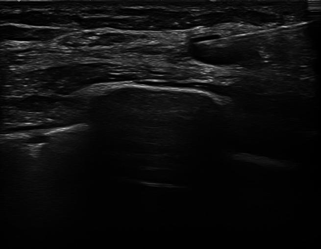 https://cdn.ncbi.nlm.nih.gov/pmc/blobs/b881/9805223/5e682276111a/JUM-41-3137-g001.jpg