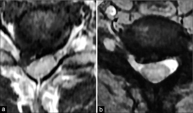 https://cdn.ncbi.nlm.nih.gov/pmc/blobs/b883/8088536/9b55f1872e67/SNI-12-141-g002.jpg