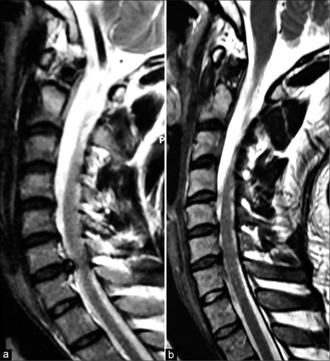 https://cdn.ncbi.nlm.nih.gov/pmc/blobs/b883/8088536/e9a322dac61a/SNI-12-141-g001.jpg