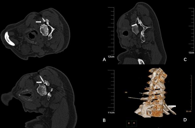 https://cdn.ncbi.nlm.nih.gov/pmc/blobs/b884/7186594/cfe81defd5fa/fnins-14-00377-g002.jpg