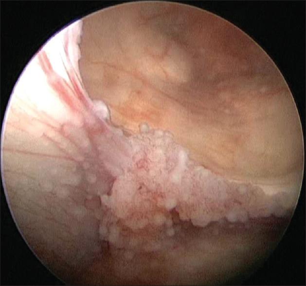 https://cdn.ncbi.nlm.nih.gov/pmc/blobs/b88e/4974953/ebe3375e0e94/AJNS-11-325-g001.jpg