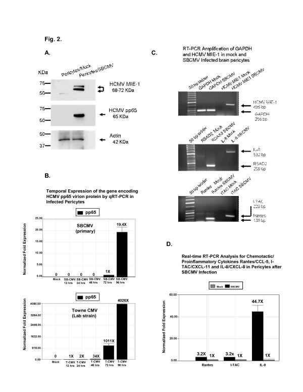 https://cdn.ncbi.nlm.nih.gov/pmc/blobs/b891/3413582/7c63980476c7/1742-2094-9-95-2.jpg