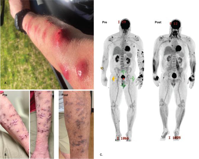 https://cdn.ncbi.nlm.nih.gov/pmc/blobs/b89a/9064978/041d9e3273bb/41467_2022_29689_Fig1_HTML.jpg