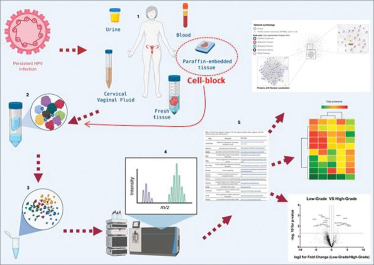 https://cdn.ncbi.nlm.nih.gov/pmc/blobs/b89e/9345115/1a5db6aa5ff5/Cytojournal-19-42-g012.jpg