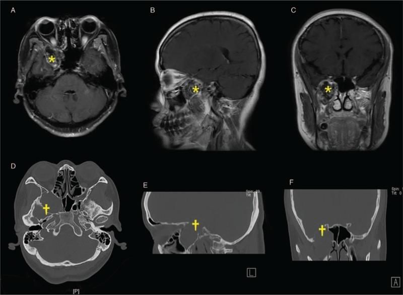 https://cdn.ncbi.nlm.nih.gov/pmc/blobs/b89f/6595853/1467554ac52a/cm9-132-798-g005.jpg