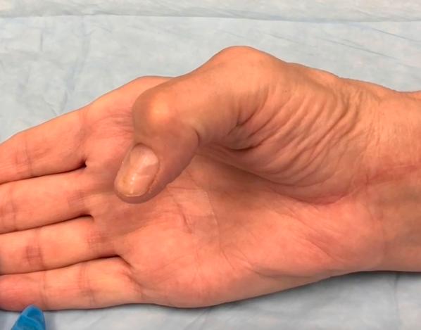 https://cdn.ncbi.nlm.nih.gov/pmc/blobs/b8a1/12147572/89354798294f/figs1.jpg