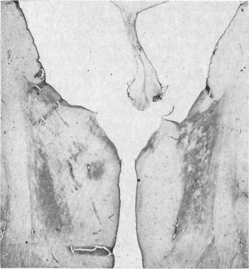 https://cdn.ncbi.nlm.nih.gov/pmc/blobs/b8a4/2019395/05154baf8c22/archdisch01576-0073-b.jpg