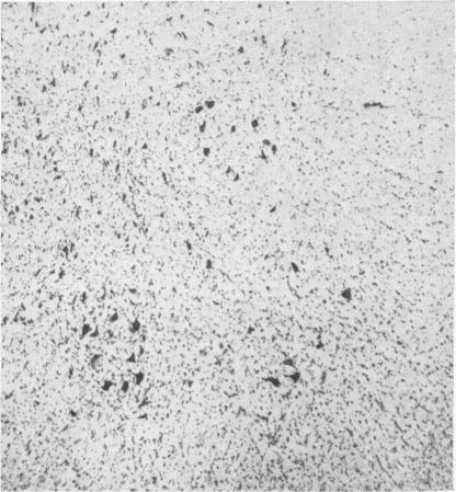 https://cdn.ncbi.nlm.nih.gov/pmc/blobs/b8a4/2019395/3e4d281ace6a/archdisch01576-0071-b.jpg