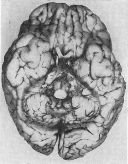 https://cdn.ncbi.nlm.nih.gov/pmc/blobs/b8a4/2019395/5e5e787720f5/archdisch01576-0071-a.jpg