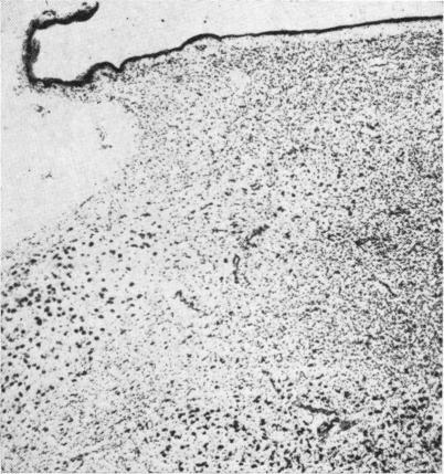 https://cdn.ncbi.nlm.nih.gov/pmc/blobs/b8a4/2019395/a7e7b0f00b22/archdisch01576-0073-c.jpg