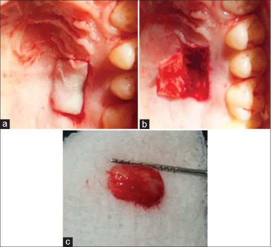 https://cdn.ncbi.nlm.nih.gov/pmc/blobs/b8aa/7592622/03428eaea3c3/JISP-24-421-g004.jpg