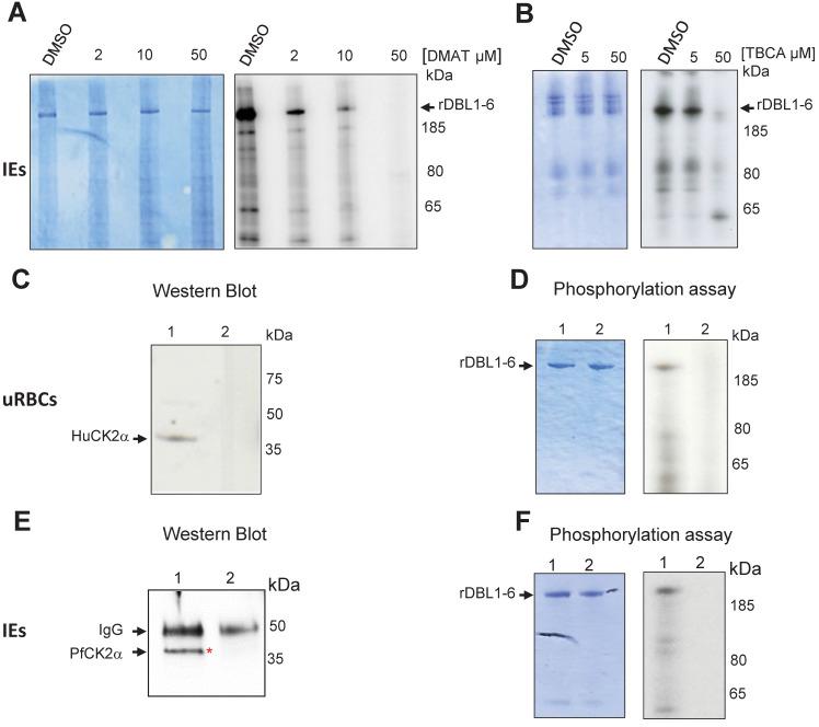 https://cdn.ncbi.nlm.nih.gov/pmc/blobs/b8b6/11761665/d79667499bd9/ppat.1012861.g002.jpg