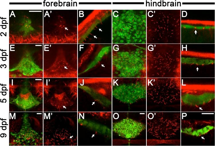 https://cdn.ncbi.nlm.nih.gov/pmc/blobs/b8b6/5861362/a9e4e7f8b03e/biolopen-7-030494-g7.jpg