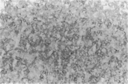 https://cdn.ncbi.nlm.nih.gov/pmc/blobs/b8bd/1865304/3d6d069f1d25/amjpathol00032-0346-a.jpg