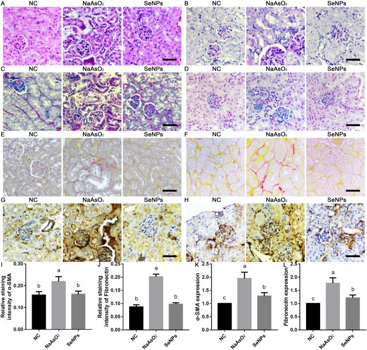 https://cdn.ncbi.nlm.nih.gov/pmc/blobs/b8bf/10276609/14b5ebb4d209/IJN-18-3157-g0003.jpg