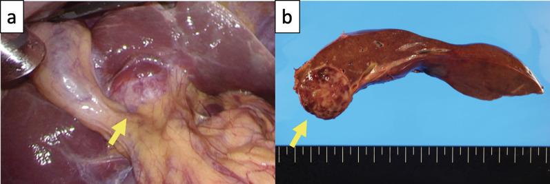 https://cdn.ncbi.nlm.nih.gov/pmc/blobs/b8c2/9733763/a7fc2b3e6eb9/40792_2022_1572_Fig2_HTML.jpg